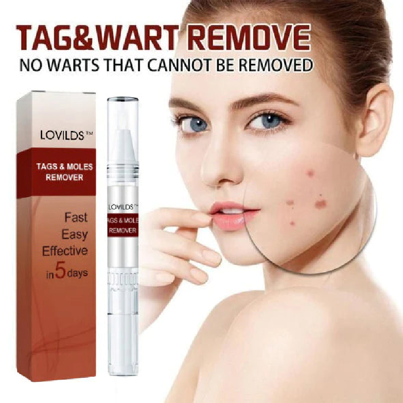 Lovilds™ Tags & Moles Remover